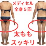 たった５回でこんなにスッキリ！！