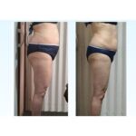 【 年末前の“リセットケア”】